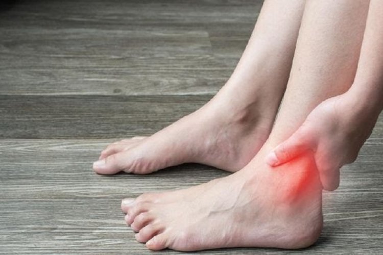 Ini 3 Penyebab Asam Urat Terus Kambuh, Berikut Kata dr Ema Super