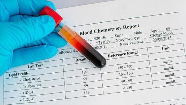 Ingin Kolesterol Tinggi Langsung Minggat, Berikut 5 Cara Mudahnya