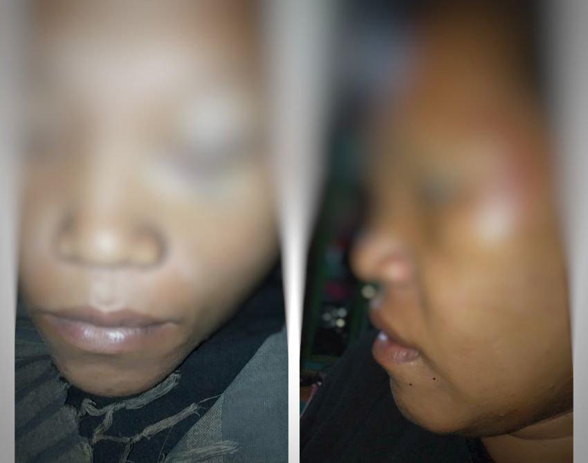Kasus Kapolsek Diduga Aniaya Seorang Wanita di Labuhanbatu Belum Ditindaklanjuti