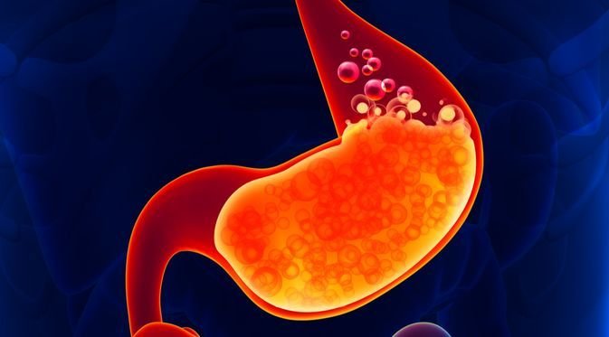 Resep Terpercaya Sembuhkan Asam Lambung dan GERD, Tinggalkan Obat Medis Sekarang