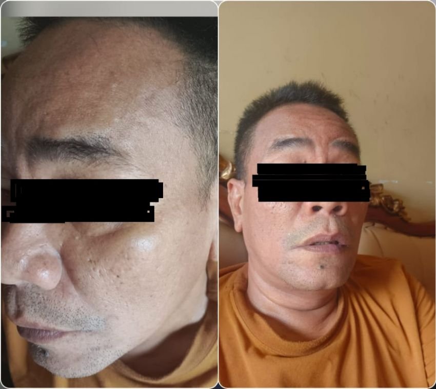Pengusaha di Medan Diduga Dianiaya Ketua OKP