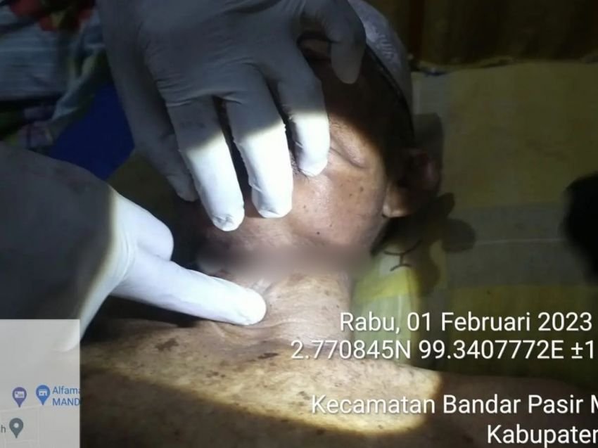 Diduga Derita Penyakit Asam Lambung Kronis, Warga BP Mandoge Nekat Gantung Diri