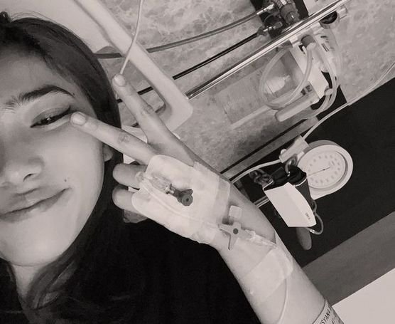 Isyana Sarasvati Didiagnosis Lupus
