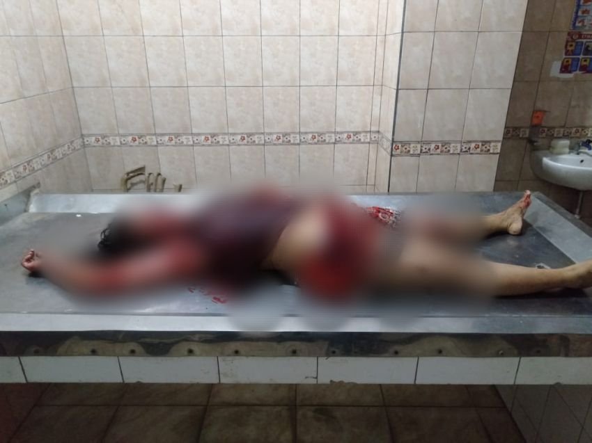 Polisi Buru Pelaku Pembacokan Satu Keluarga di Binjai