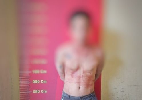 Terduga Pelaku Pencurian Babak Belur Dihajar Massa