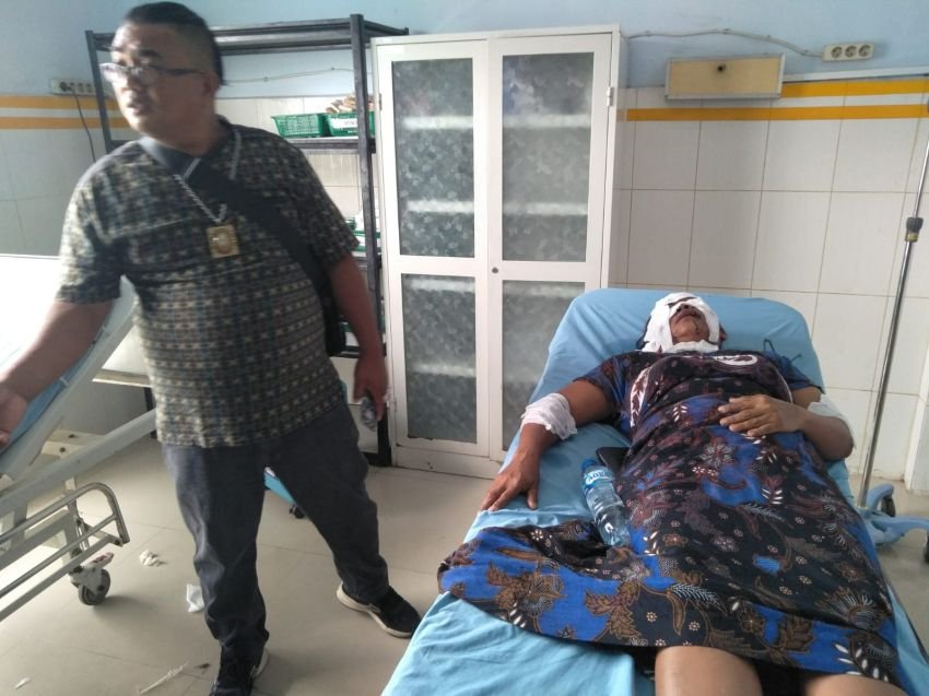Sadis, Seorang Wanita di Madina Disiram Air Keras, Diduga Dendam Lama Pelaku
