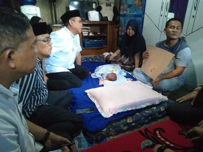Bayi di Madina Derita Penyakit Cairan Bokong, Pemerintah Gerak Cepat Tanggung Biaya Perobatan