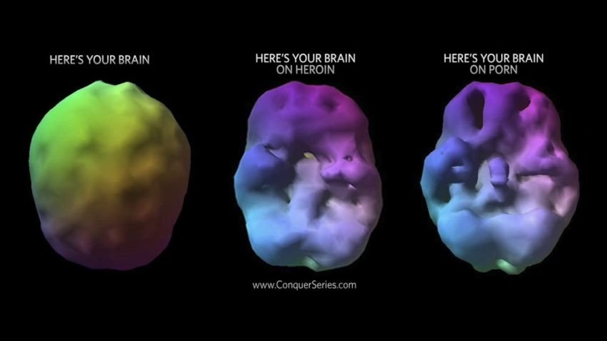 Benarkah Otak Orang yang Kecanduan Pornografi Tidak Seperti Otak Pada Umumnya?
