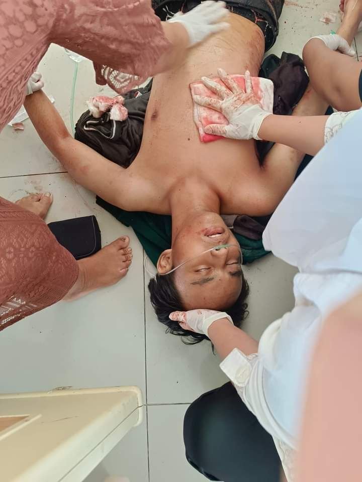Mahasiswa UMA Terkapar Ditebas Begal, TKP Deli Serdang