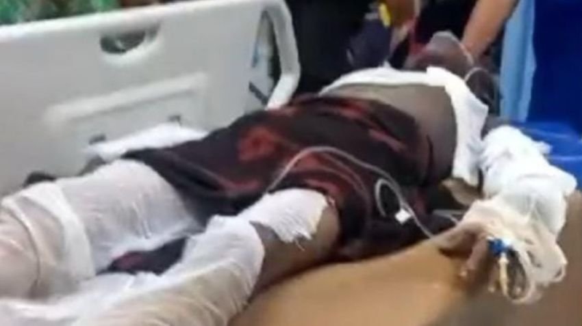 Tragis! Bangun Tidur HP Hilang, Teman Bakar Teman di Deliserdang