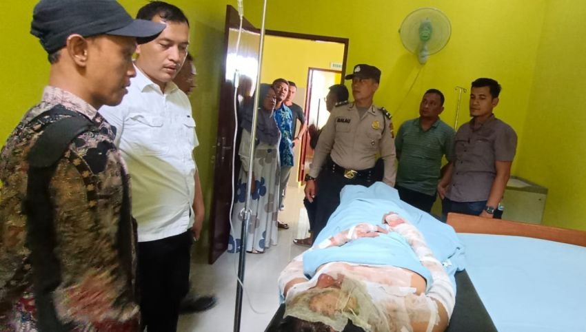 Tersulut Api Cemburu dan Sempat Cekcok, Suami di Langkat Tega Bakar Mantan Istri