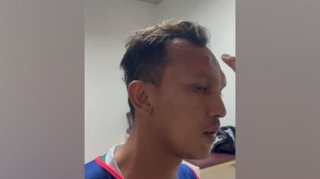 Dahi Kapten PSMS Rahmat Hidayat Benjol, Diduga Dipukul Petinggi Persiraja