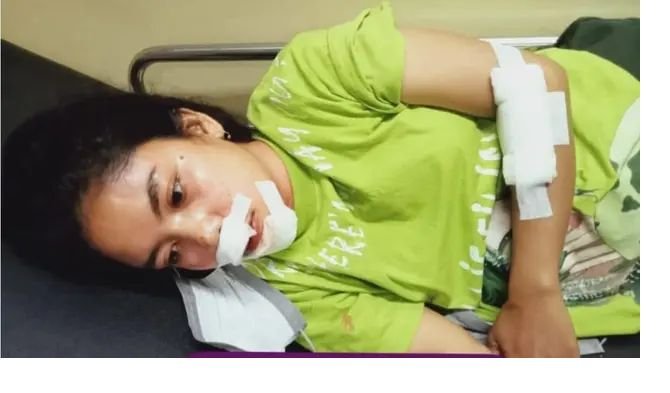 Aksi Wanita Pemilik Kios di Kupang Melawan Pencuri Hingga Kena Tendang dan Gigi Patah