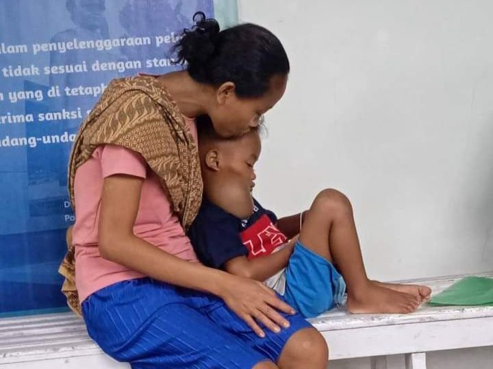 Pemerintah Siap Fasilitasi Biaya Operasi Mario