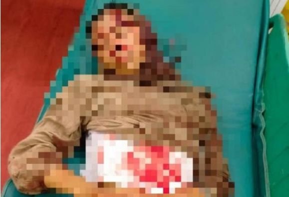 Viral Seorang Wanita Jadi Korban Perampokan di Peureulak dan Idi Rayeuk, Begini Faktanya
