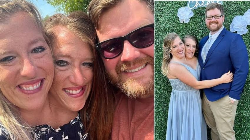 Kabar Abby-Brittany Hensel Wanita Kembar Siam Nikah dengan Veteran Angkatan Darat AS