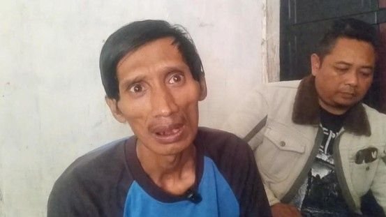 Kisah Solihin, Pria Asal Garut yang 4 Tahun Tak Tidur