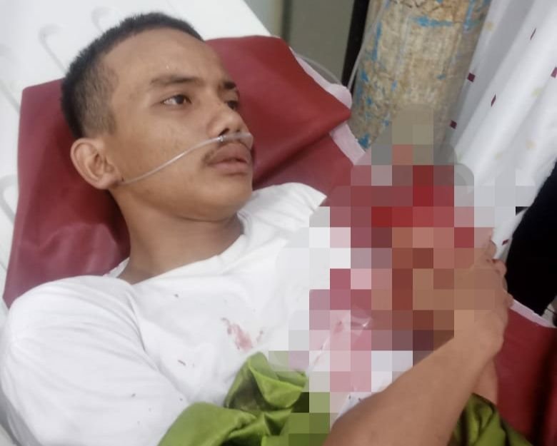 Tiga Pemuda di Deli Serdang Terkapar Dibacok Geng Motor