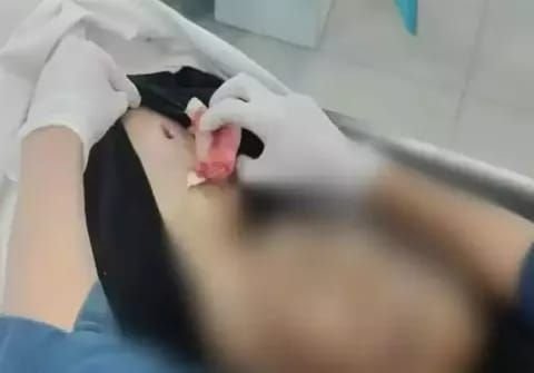 LBH Medan Desak Polisi Segera Ungkap Kasus Penembakan Gegerkan Sergai